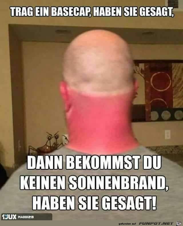 Kein Sonnenbrand, oder doch ? Kein Sonnenbrand, oder doch ?