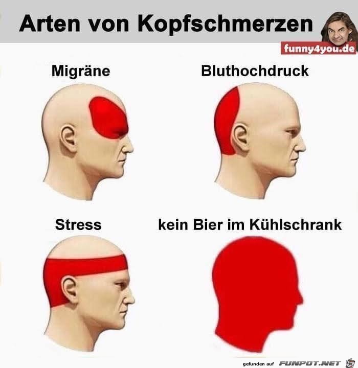 Kopfschmerzen Kopfschmerzen