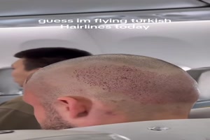 Turkish Hairlines